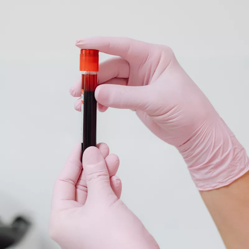 lab testing diagnostics